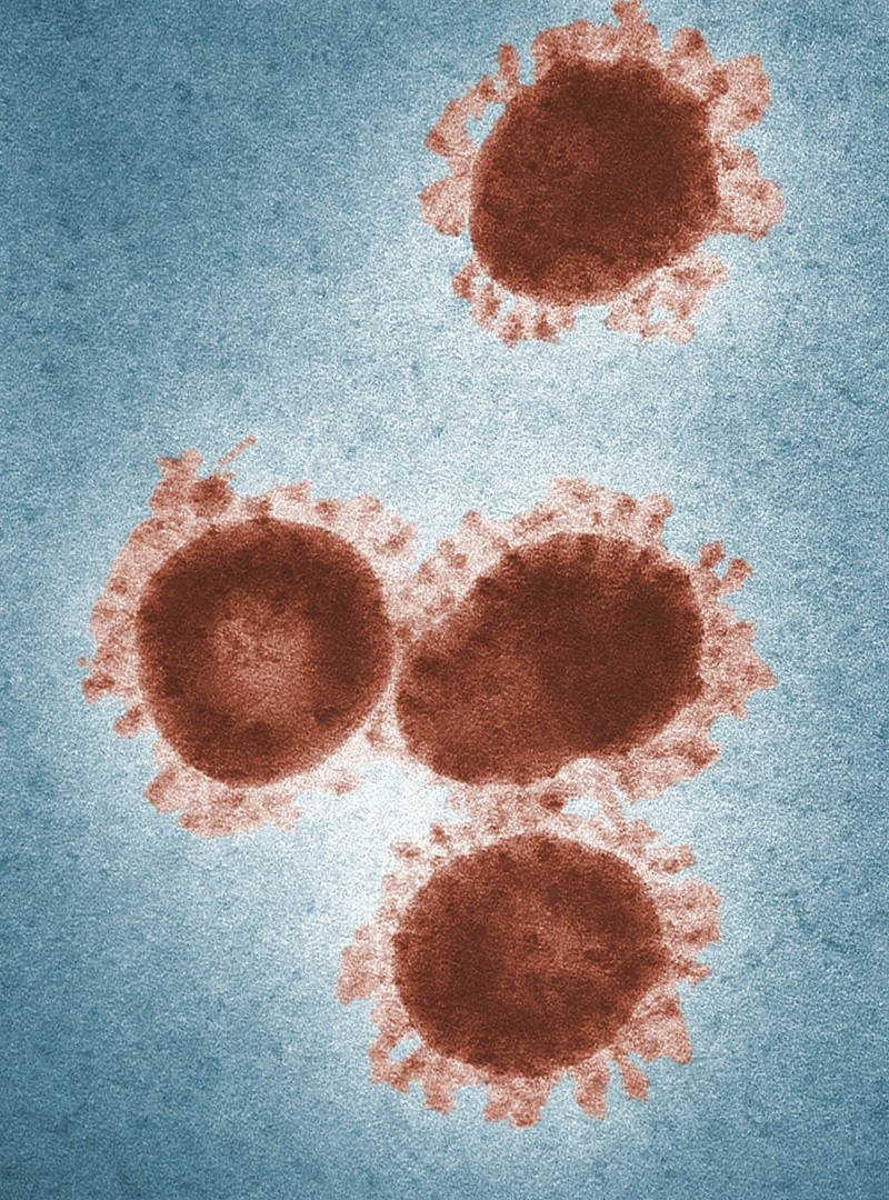 El virus de Marburgo si se puede trarar con diversas terapias de apoyo. Foto de CDC en Pexels.  