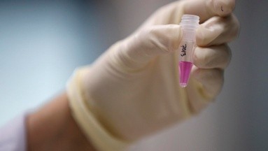 México se prepara para combatir la viruela símica mediante ensayos clínicos con Tecovirimat