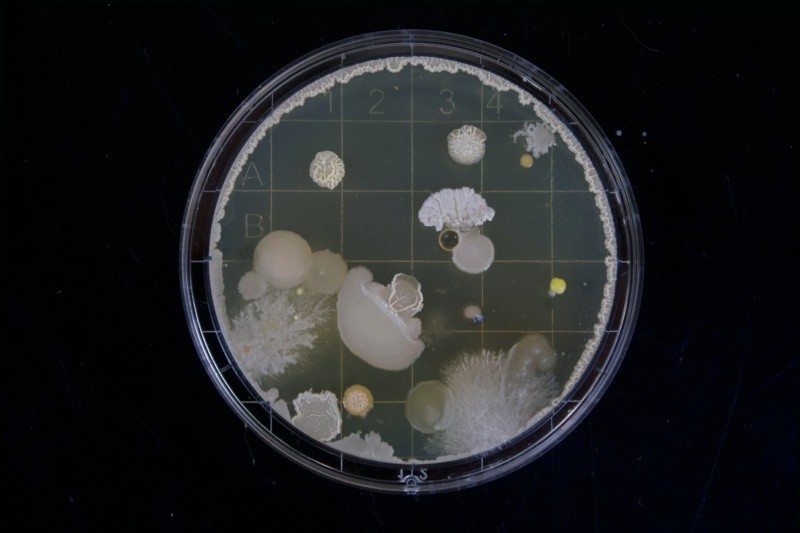Los médicos han estado tratando infecciones por hongos con éxito utilizando terbinafina oral, pero esta nueva especie de hongo es resistente a ese tratamiento. FOTO:Michael Schiffer/UNSPLASH