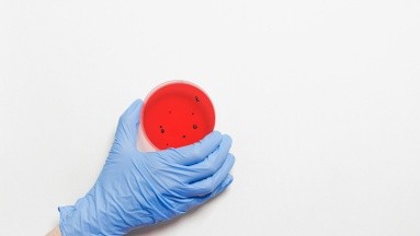 La microbiota: ¿Qué es y cómo impacta en la salud?