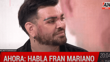 Fran Mariano: Bailarín argentino acusa que quedó desfigurado por inyecciones de silicona