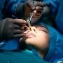 Mujer viaja a Turquía para una operación de nariz pero asegura que nunca se la hicieron
