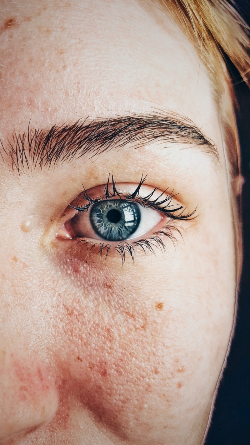 Reconoce los síntomas del cáncer ocular y busca atención inmediata cuanto antes FOTO: Almada Studio