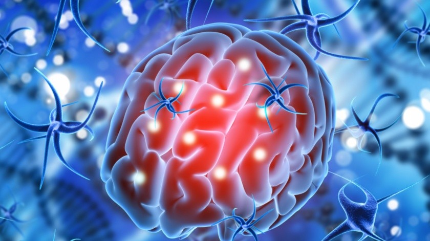 La esclerosis múltiple puede afectar el cerebro.(Imagen por kjpargeter en Freepik)