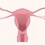 Una ETS poco común puede aumentar el riesgo de desarrollar cáncer de cuello uterino, según estudio