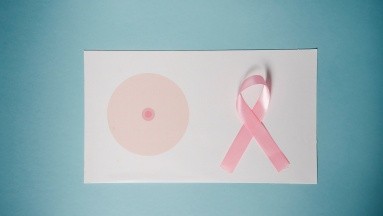Cáncer de mama: Optimizar la terapia evita la quimio a un 30% de pacientes