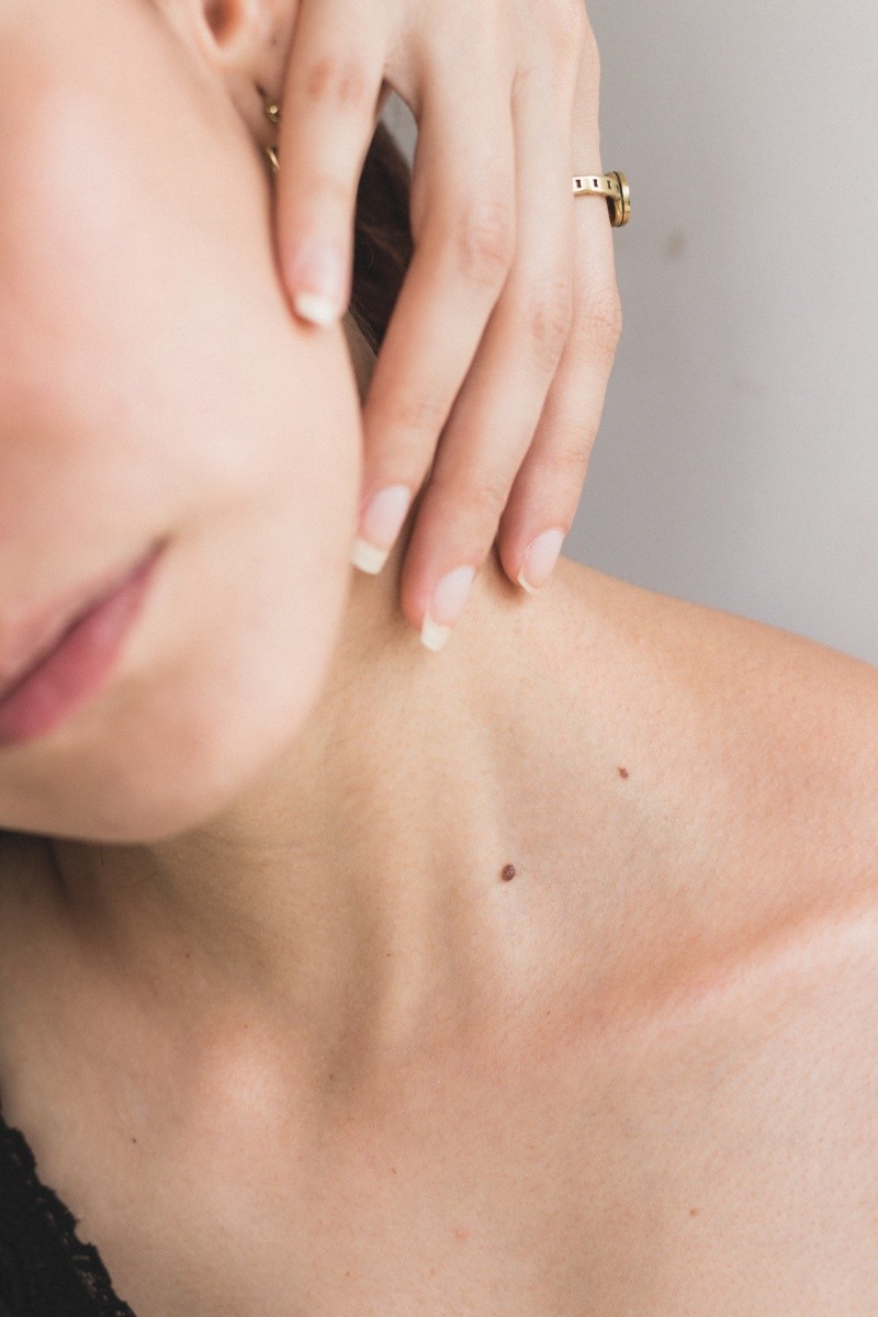  Consulta a un dermatólogo si notas cambios en tus lunares o manchas en la piel. FOTO:Angélica Echeverry/UNSPLASH