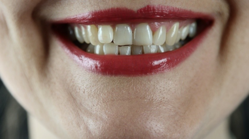 El aliado clave para unos dientes fuertes y sanos(Marek Studzinski/UNSPLASH)