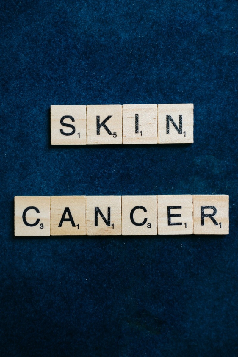El cáncer de piel se puede prevenir.  Foto de Anna Tarazevich en Pexels. 
