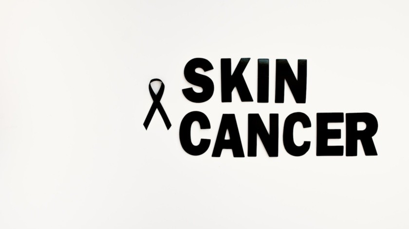 El cáncer de piel puede afectar a cualquier persona.(Tara Winstead en Pexels.)
