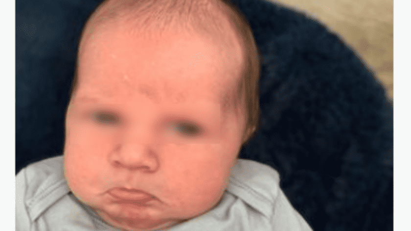 El bebé tenía problemas de salud comenzó a vomitar y mostraba una expresión facial de malestar.(Rebeca Edwards)