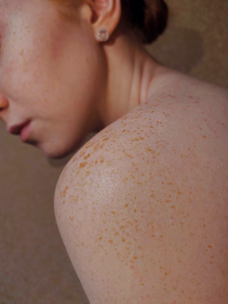 El clima tiene una gran influencia en tu piel, llegó el momento d comenzar a protegerla. FOTO:Valeria Smirnova/UNSPLASH