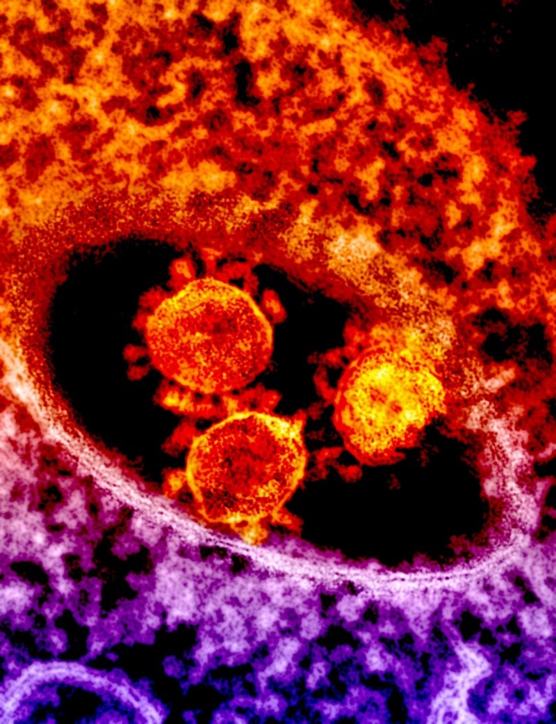 La E.Coli es un tipo de bacteria. Foto de CDC en Pexels.  