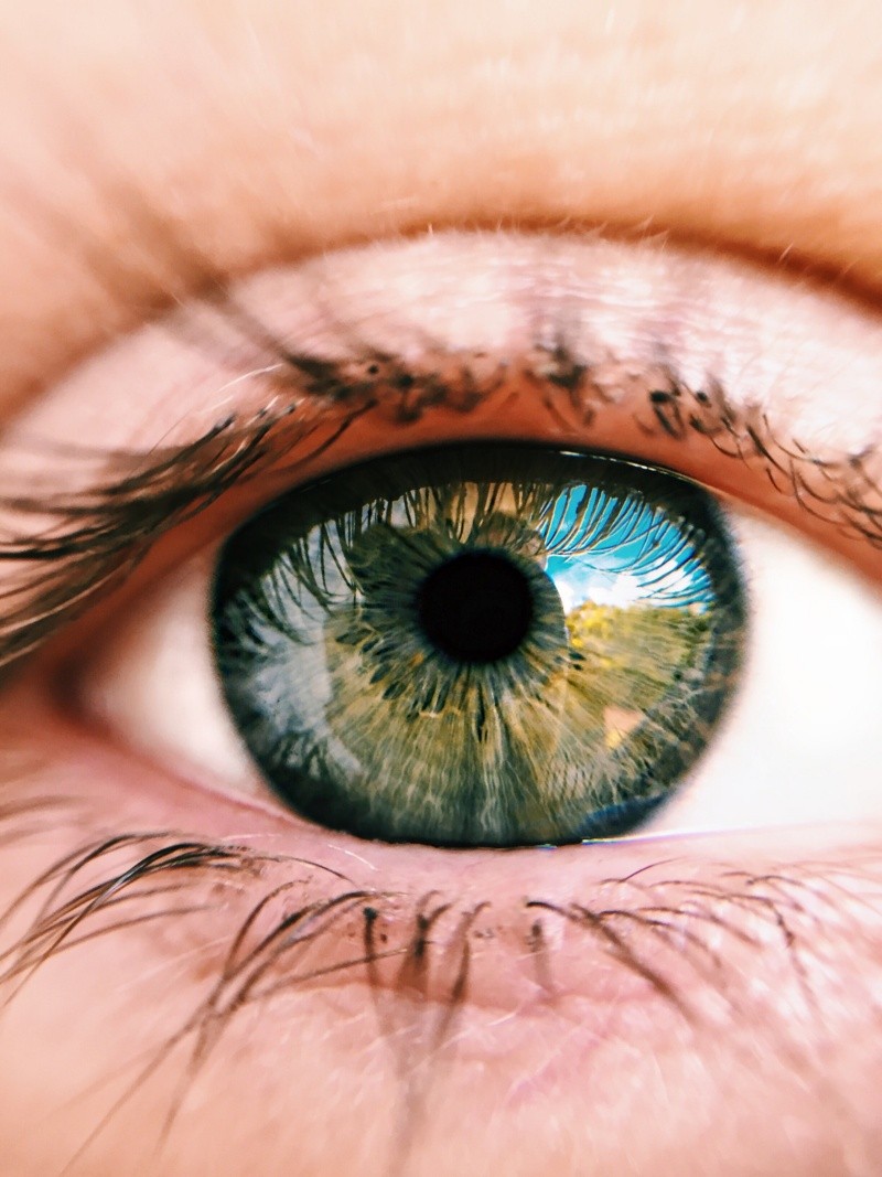 Los ojos pueden indicar otras enfermedades a los oftalmólogos.  Foto de wendel moretti en Pexels. 