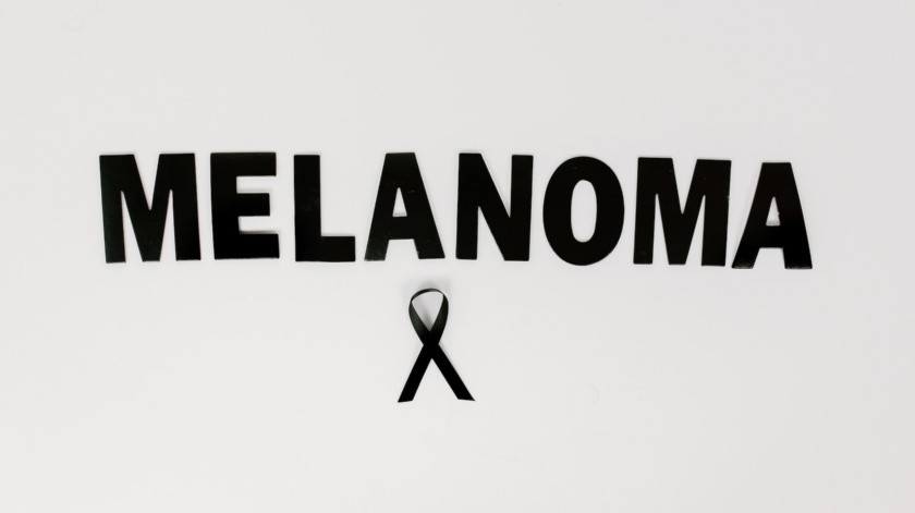 El melanoma la mayoría de las veces se puede prevenir.(Tara Winstead en Pexels.)