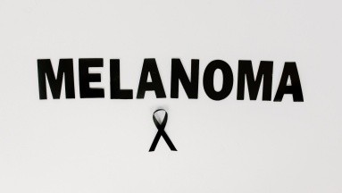 Revelan cómo los trasplantes fecales pueden ser claves en el tratamiento de melanomas