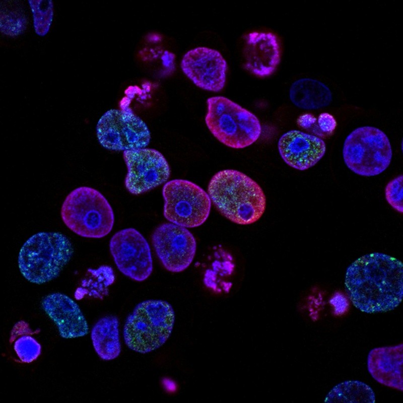 El cáncer se origina cuando las células comienzan a crecer sin control. Casi cualquier célula del cuerpo puede convertirse en cáncer y propagarse a otras áreas. FOTO:National Cancer Institute/PEXELS