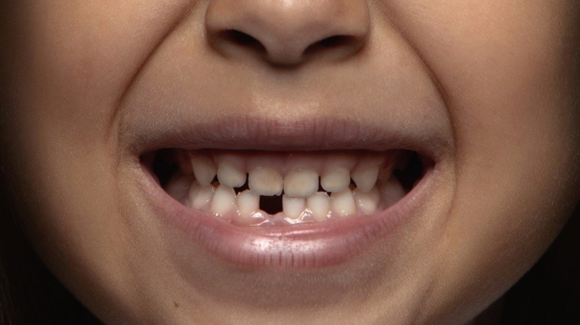A un niño en la India le encontraron más de 500 dientes en su boca.(Foto por master1305 en Freepik)