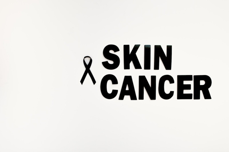 El cáncer de piel es por mucho el más común entre todos los tipos de cáncer. FOTO Tara Winstead/PEXELS