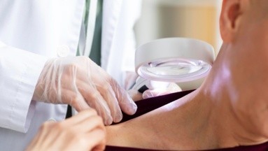 Medicamento para dolencias cardiacas podría mejorar terapias para el melanoma: Estudio