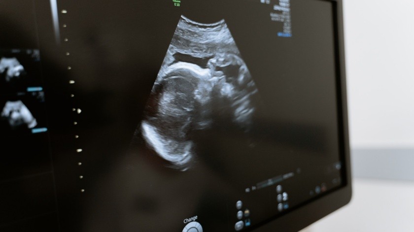 El feto momificado de 40 años que dejó perplejos a los médicos en Durango(MART PRODUCTION/PEXELS)