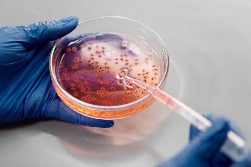 Las infecciones por Vibrio tienden a aumentar considerablemente después de los huracanes. FOTO: Edward Jenner/pexels