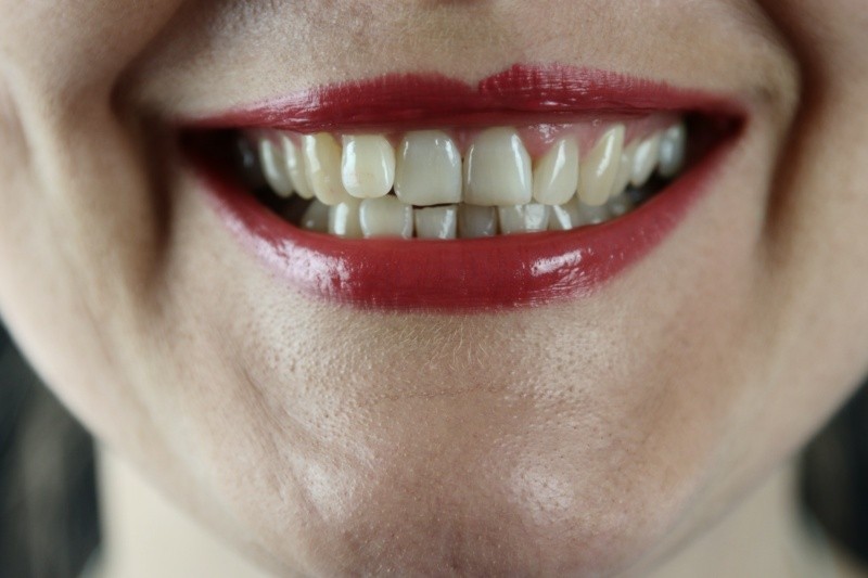Los dientes son estructuras delicadas que deben ser tratadas con cuidado foto:Marek Studzinski/unsplash