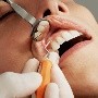 Consejos para prevenir el sarro dental