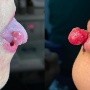 Arabia Saudita: Dos mujeres embarazadas sufren raros tumores en labios y lengua