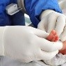 Alarmante aumento de casos de sífilis en recién nacidos en Estados Unidos