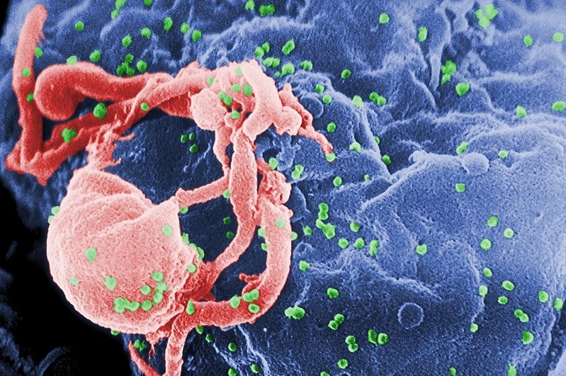   El paciente de Londres, un caso de curación de VIH y cáncer, quiere compartir un mensaje de esperanza a la ciencia. Foto: Archivo