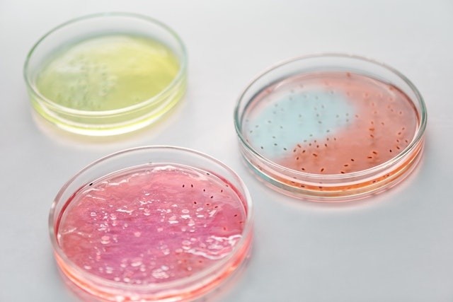  Esta bacteria puede presentarse de diferentes maneras y amenaza a los niños. 