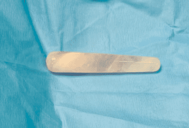 El objeto medía casi 10 cm de largo (4 pulgadas) y 2,5 cm de ancho (1 pulgada), mismo que consideran uno de los objetos más anchos de expulsar. FOTO  Urology Case Reports