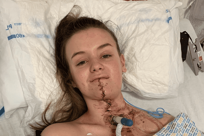  Rachel Morton pensó que sus úlceras eran por estrés pero resultó ser cáncer de lengua. Foto:  Teenage Cancer Trust