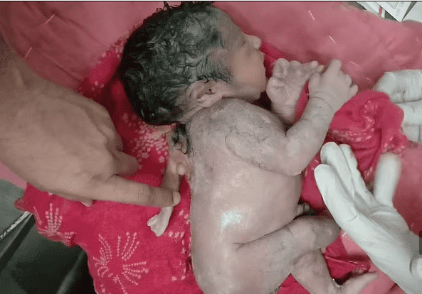  La imagen muestra al bebé acostado de lado y llorando cuando alguien tocó la extremidad adicional. FOTO: Jam Press Vid/Rare Shot News
