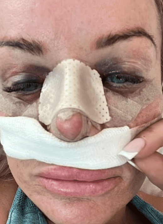 La mujer de 39 años asegura que nunca le realizaron la operación de nariz. FOTO:Sharon Maxwell.